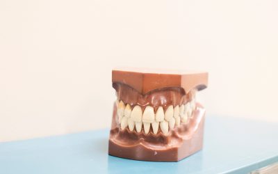 Why Is Keeping Your Gums Healthy So Important?